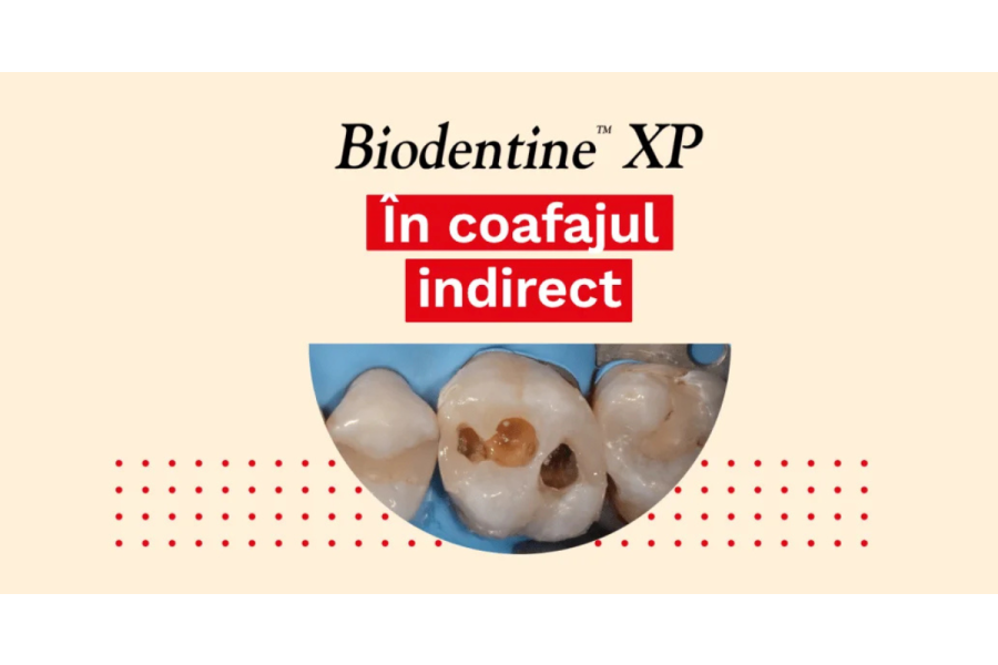 Biodentine XP &icirc;n coafajul indirect &ndash; caz clinic de Dr. Ganowicz