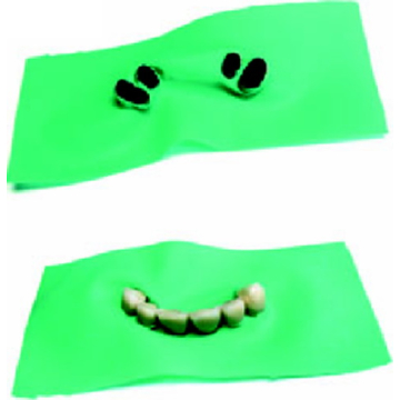 Diga Coroane 2 buc/pg DFS