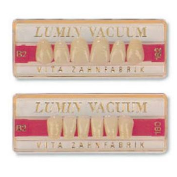 Vita Lumin anterior
